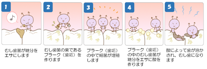 むし歯菌は糖分をエサにしてプラーク(歯垢)を作り、プラーク中で細菌が増殖します。その細菌は糖分をエサにして酸を作ります。その酸によって歯が溶かされ、むし歯になってしまいます。